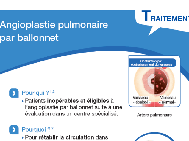 Traitements - Angioplastie pulmonaire par ballonnet (APB)