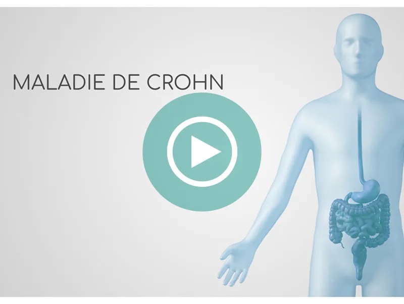 Vivre maladie de Crohn