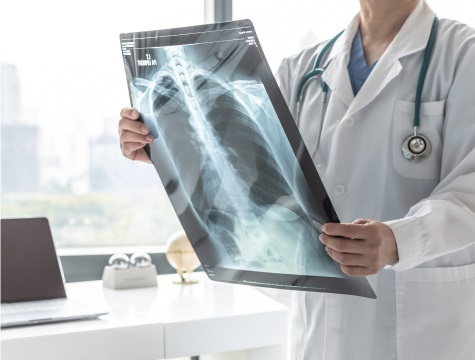 Un médecin examine une radiographie