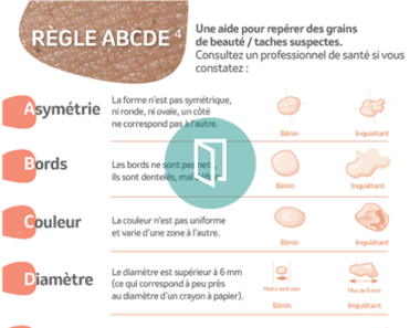dépistage mélanome règle abcde