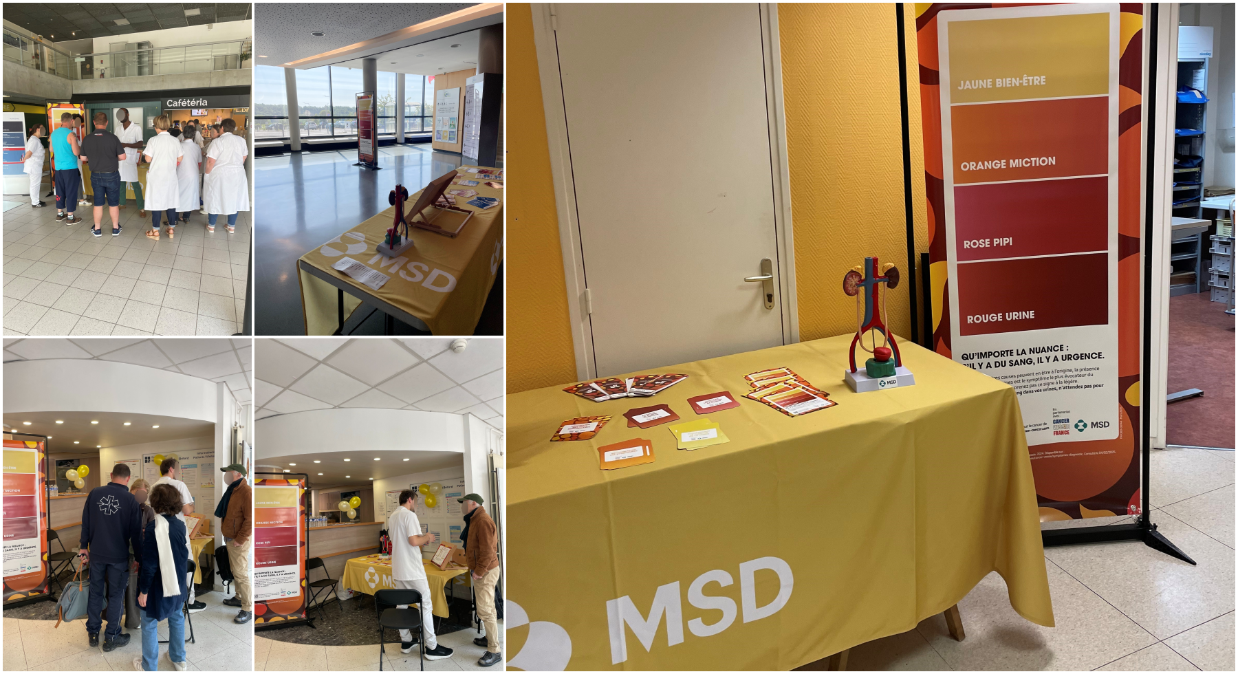 opération sensibilisation cancer de la vessie