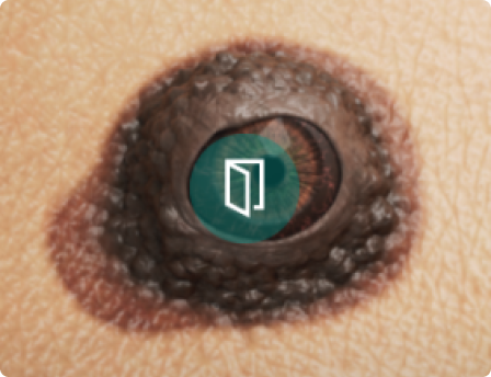 brochure sensibilisation mélanome