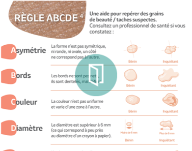 dépistage mélanome règle abcde
