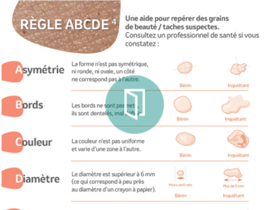 règle ABCDE