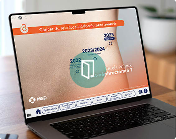 risque de récidive post-néphrectomie