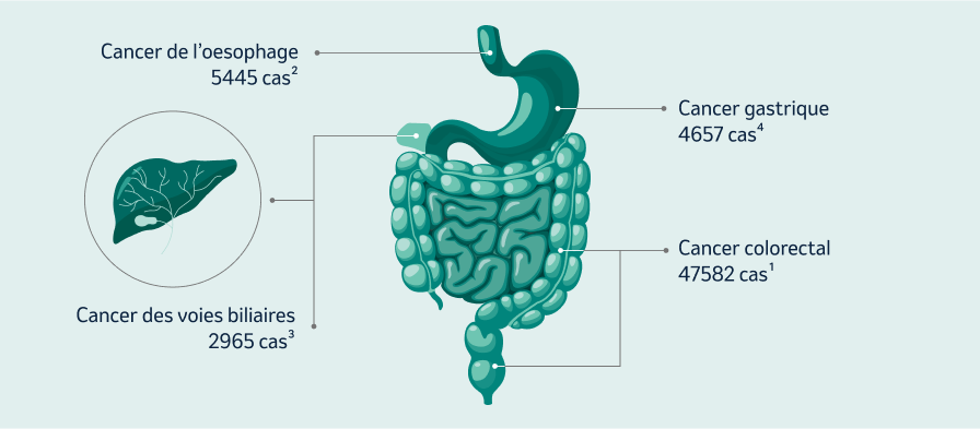 les cancers gastro-intestinaux