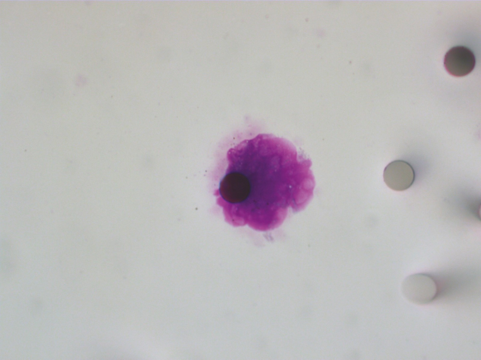 Signatures prédictives cancers digestifs