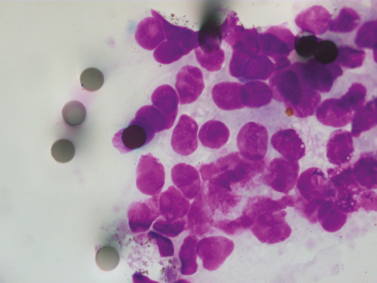 Signatures prédictives cancers digestifs