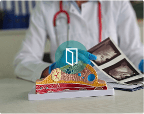 analyse d'un cancer du sein