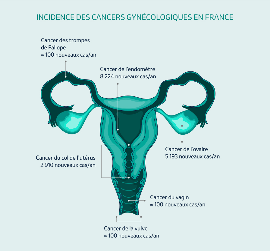 incidence des cancers gynécologiques en France