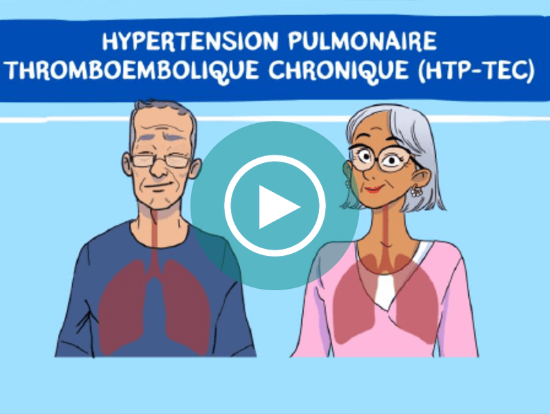 La prise en charge de l_HTP-TEC